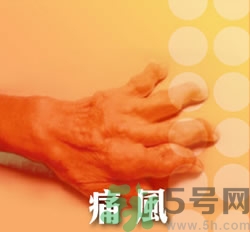 骨關(guān)節(jié)炎能治好嗎？骨關(guān)節(jié)炎平時注意事項