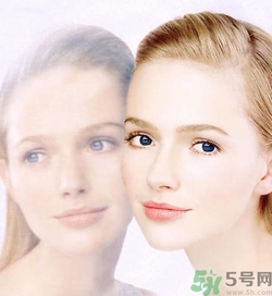 曬斑可以自己消退嗎？曬斑可以用激光去除嗎？