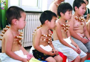 小孩可以拔罐嗎？寶寶能拔火罐嗎？