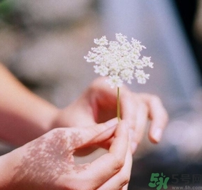 手指被門(mén)夾了有淤血怎么辦？手指被門(mén)夾了有淤血怎么處理？
