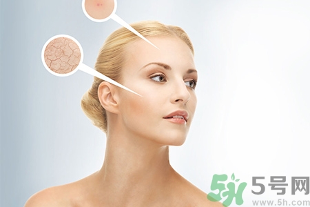 甘油會(huì)堵塞毛孔嗎？甘油堵塞毛孔怎么辦？