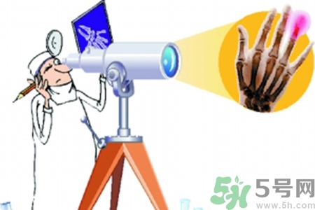 什么年齡測骨齡最好？如何測骨齡？
