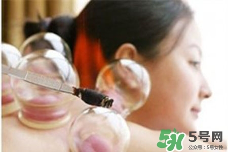 拔罐放血對身體好嗎？拔罐放血有什么好處？