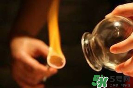 拔罐放血對身體好嗎？拔罐放血有什么好處？