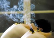 落枕能艾灸嗎？艾灸治療落枕有用嗎？