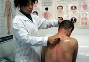 刮痧后什么顏色才健康？刮痧顏色反映的病癥