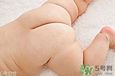 擴(kuò)肛有什么好處？擴(kuò)肛需要注意什么？