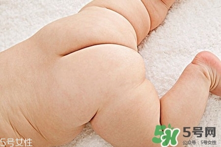 擴肛疼嗎？擴肛手術(shù)會很疼嗎？