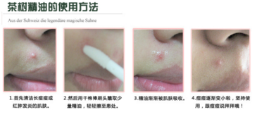 the body shop茶樹(shù)精油怎么用？美體小鋪茶樹(shù)精油怎么打開(kāi)
