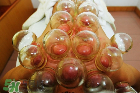 拔罐后皮膚發(fā)癢是怎么回事？拔罐后為什么皮膚會癢？