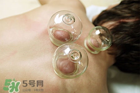 拔罐后皮膚發(fā)癢是怎么回事？拔罐后為什么皮膚會癢？