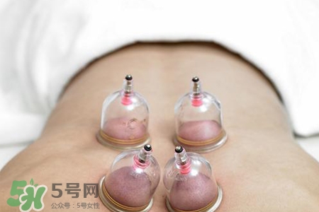 冬天拔罐好還是刮痧好？冬天刮痧和拔罐哪個效果好？