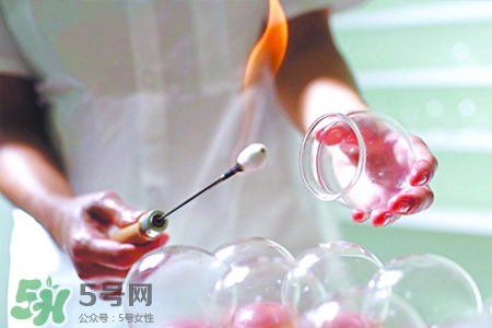 冬天拔罐后多久能洗澡？警惕冬季拔罐后不宜立即洗澡