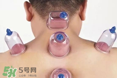 拔罐后可以喝酒嗎？拔罐后多久能喝酒？