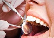 拔牙之后可以吃藥嗎？拔牙之后要不要吃藥？