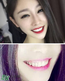 碧緹福冷光牙齒美白儀怎么用？碧緹福冷光牙齒美白儀使用方法