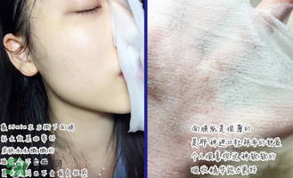 稚優(yōu)泉面膜怎么用？稚優(yōu)泉面膜要洗嗎？