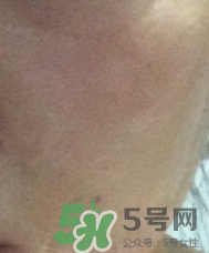 skin1004是什么牌子？skin1004屬于什么檔次