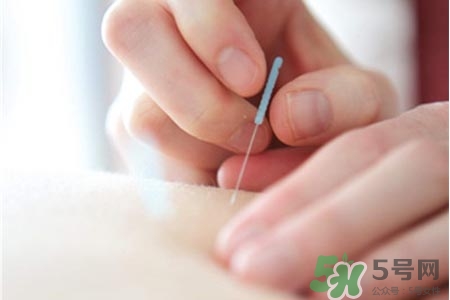 腰間盤突出可以針灸嗎？針灸能治腰間盤突出嗎？