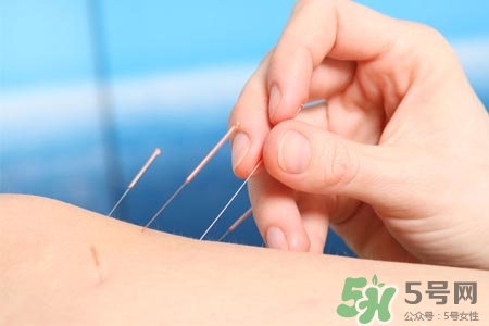 腰間盤突出可以針灸嗎？針灸能治腰間盤突出嗎？