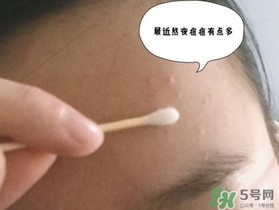 星期四農(nóng)莊茶樹精油怎么用？星期四農(nóng)莊茶樹精油使用方法