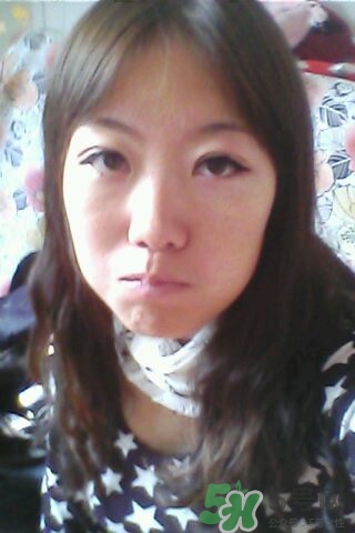 什么是定點(diǎn)雙眼皮？定點(diǎn)雙眼皮多少錢？