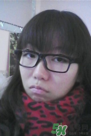 什么是定點(diǎn)雙眼皮？定點(diǎn)雙眼皮多少錢？