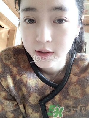 什么是定點(diǎn)雙眼皮？定點(diǎn)雙眼皮多少錢？