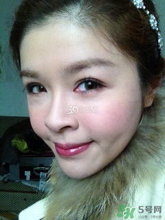 重瞼術(shù)是什么？重瞼術(shù)是永久的嗎？