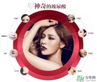喬雅登是哪個(gè)國(guó)家的？喬雅登玻尿酸哪個(gè)國(guó)家？
