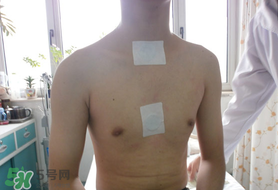 三九貼怎么貼？三九貼的貼法