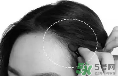 發(fā)際線(xiàn)高適合什么發(fā)型？發(fā)際線(xiàn)高怎么辦