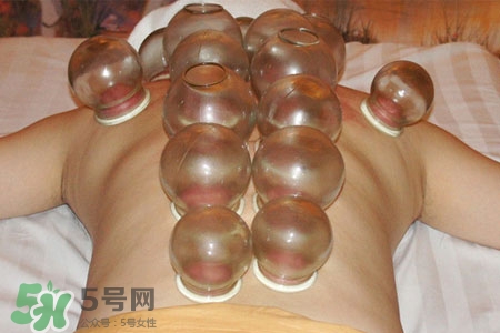 冬天可以拔罐放血嗎？冬天拔罐放血好嗎？