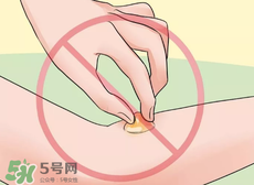 水泡怎么處理？水泡要不要刺破？