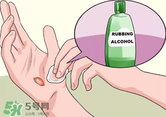 水泡怎么處理？水泡要不要刺破？