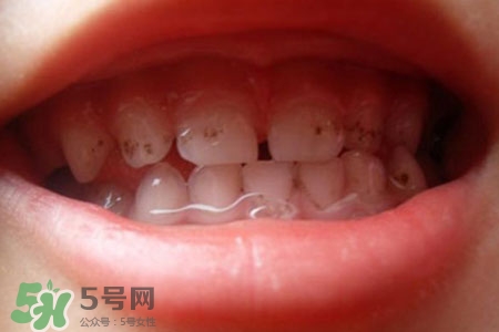 刷牙后吃東西發(fā)苦正常嗎？為什么刷牙后吃東西發(fā)苦？