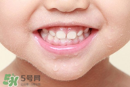 刷牙后吃東西發(fā)苦正常嗎？為什么刷牙后吃東西發(fā)苦？