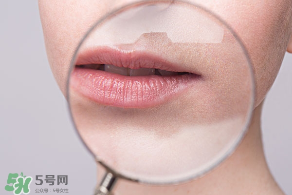 嘴唇起泡腫了怎么辦？嘴唇起泡腫了怎么消腫