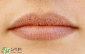 卡唇紋是什么意思？卡唇紋怎么辦？