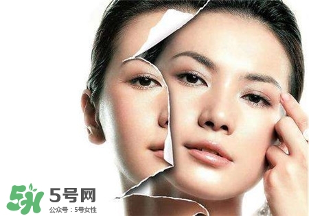 美白針是什么？美白針可以連續(xù)打嗎？