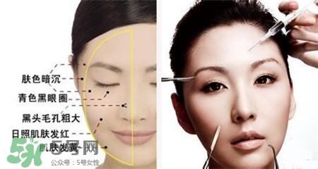 美白針的效果明顯嗎？美白針一個療程幾次？