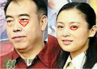臥蠶是黑眼圈嗎？臥蠶和黑眼圈的區(qū)別
