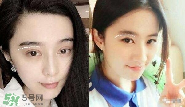 割雙眼皮有幾種做法？雙眼皮有哪幾種形狀？