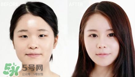 割雙眼皮有什么后遺癥嗎？割雙眼皮有什么危害性？
