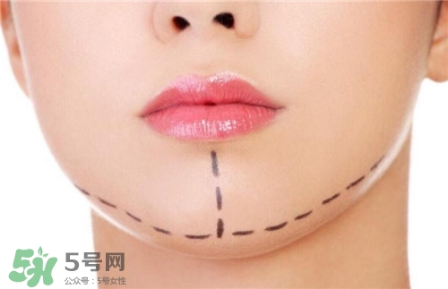 玻尿酸墊下巴能維持多久？玻尿酸墊下巴能維持多長時間？