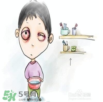 紅眼病是怎么引起的？紅眼病怎么產(chǎn)生的