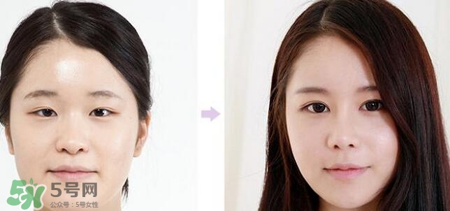 哪些人需要開(kāi)眼角？需要開(kāi)眼角的眼睛圖片