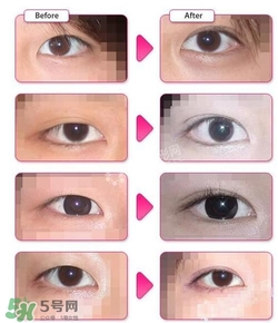 哪些人需要開(kāi)眼角？需要開(kāi)眼角的眼睛圖片