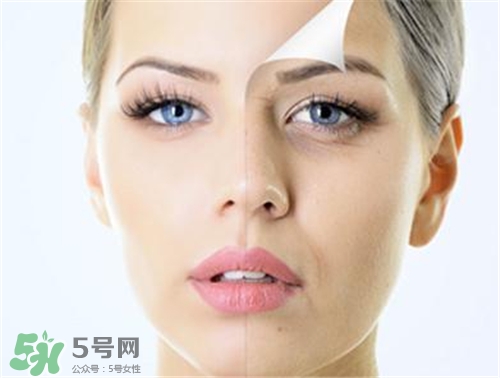 玻尿酸除皺有效果嗎？玻尿酸除皺效果怎么樣？