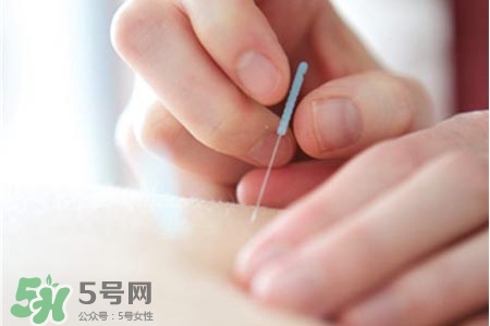 沒病可以針灸嗎？沒病可以扎針嗎？